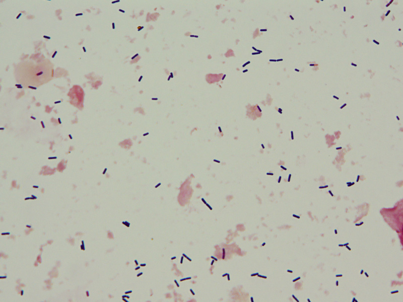 Clostridium perfringens - image