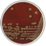 <em>Corynebacterium</em>