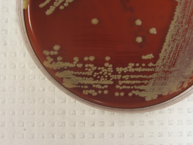 Corynebacterium - image