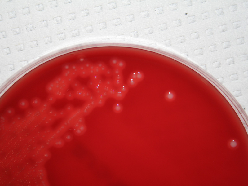 Streptococcus agalactiae - image