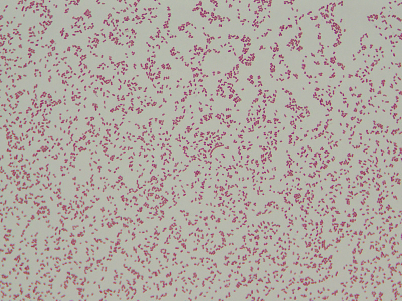 Gram Negative - image