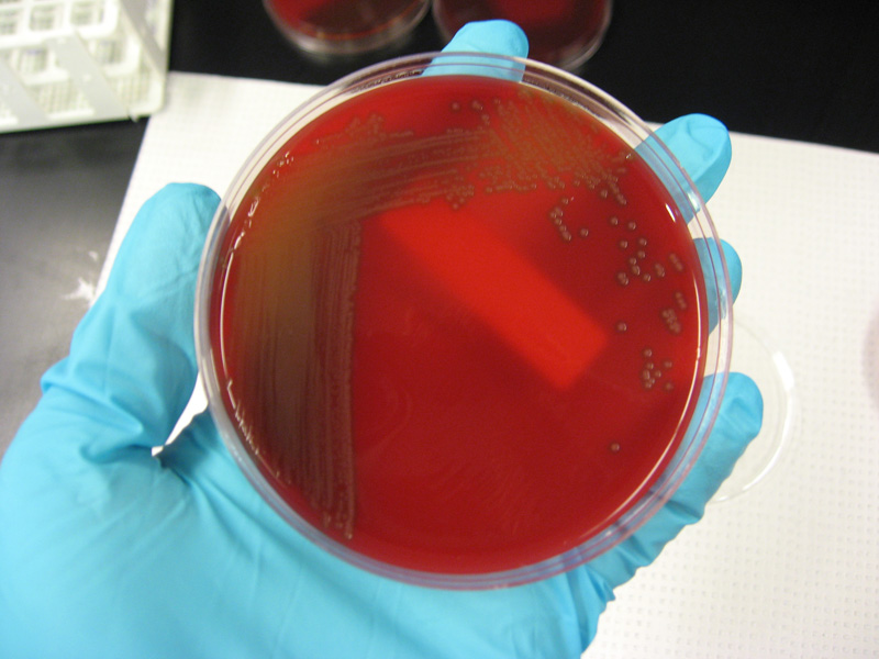 Streptococcus pneumoniae - image