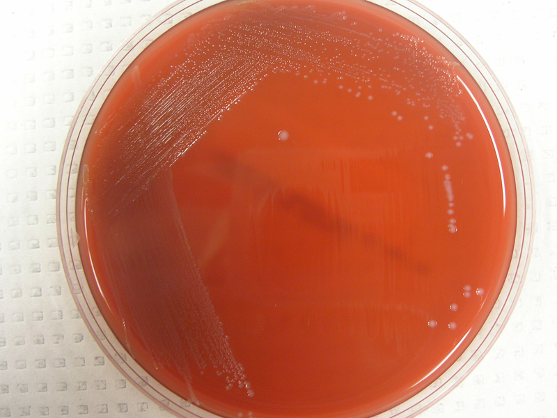 Enterococcus - image