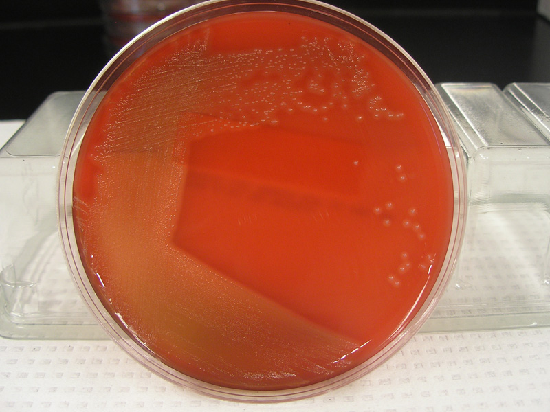 Streptococcus pyogenes - image