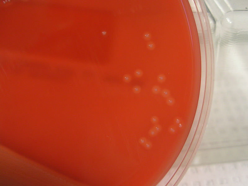 Hemolysis - image