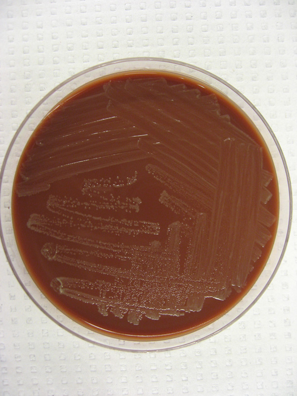 Haemophilus parainfluenzae - image