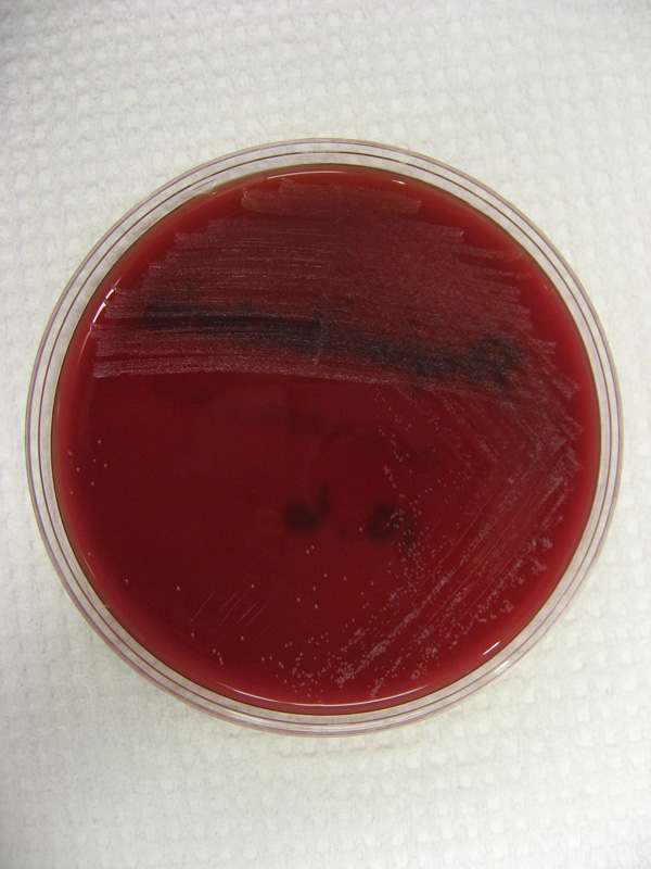 Propionibacterium - image