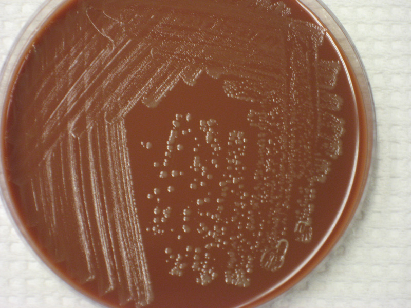 Haemophilus influenzae - image