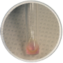 Porphyrins Positive