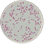 Bipolar Staining Bacilli