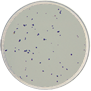 Gram Positive Cocci