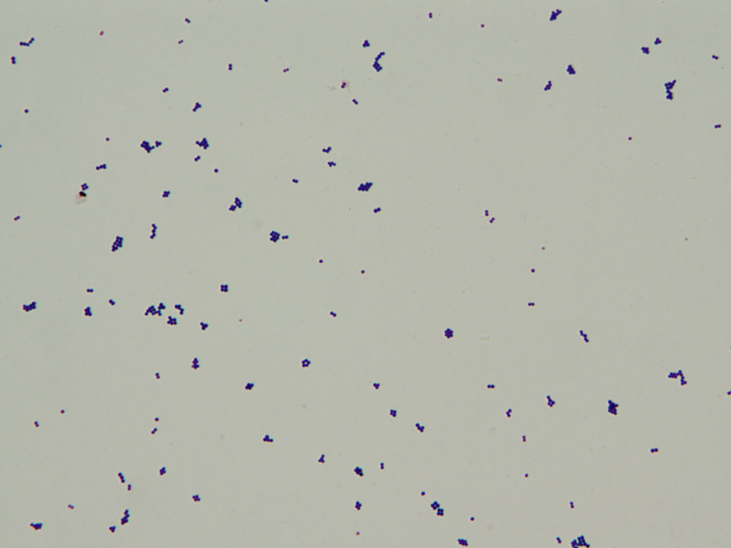 Gram Positive Cocci - image