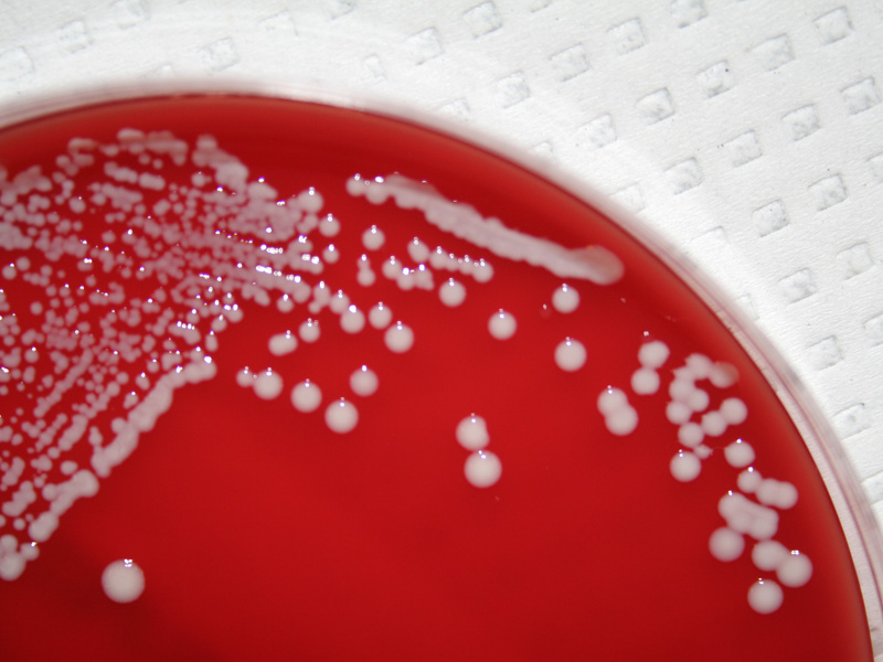 Staphylococcus saprophyticus - image