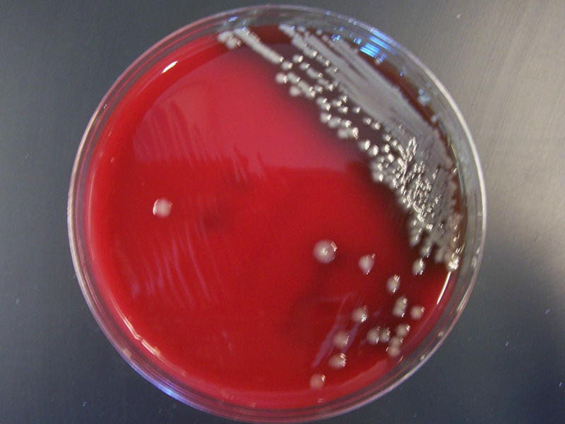 Vibrio species - image